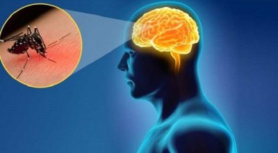 Viêm não Nhật Bản có triệu chứng gì, nguy hiểm không?