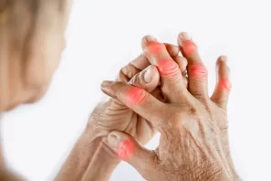 Viêm Khớp Dạng Thấp Là Gì? Cách Sống Khỏe Với Bệnh Lý Mãn Tính Này
