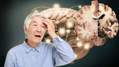 Suy giảm trí nhớ và Alzheimer – Hiểu đúng để phòng ngừa kịp thời