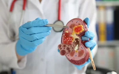 Bệnh Thận Mạn: Những Điều Người Bệnh Cần Biết Để Sống Khỏe Mạnh 