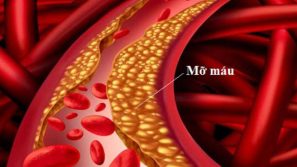Máu Nhiễm Mỡ – Căn Bệnh Âm Thầm Nhưng Nguy Hiểm Thường Gặp Ngày Nay