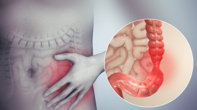 Hội Chứng Ruột Kích Thích: Căn Bệnh Dễ Mắc Nhưng Khó Nói