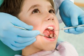 Sâu răng ở trẻ: Nguyên nhân, dấu hiệu nhận biết