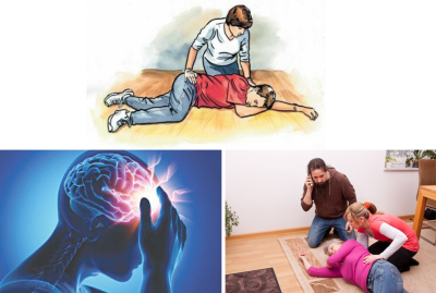 Đột Quỵ: 5 Dấu Hiệu Nhận Biết Sớm Có Thể Cứu Sống Người Thân