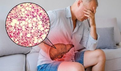 Những nguyên nhân chính gây ra tình trạng tăng men gan