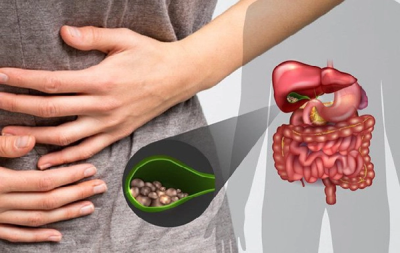 Những dấu hiệu cảnh báo sỏi mật