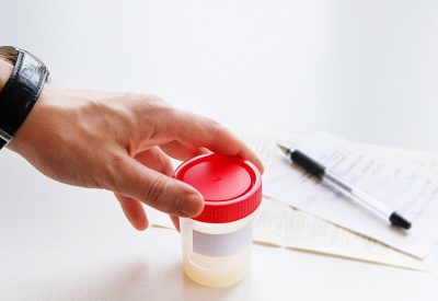 Tinh dịch đồ là gì, vì sao cần làm tinh dịch đồ?