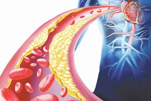 Mỡ máu cao có nguy hiểm không?