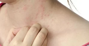 Những dấu hiệu cảnh báo bệnh thận