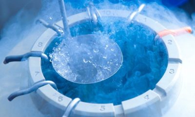 Trữ trứng, trữ tinh trùng là gì?