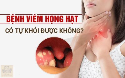 Viêm họng hạt: Những điều cần biết