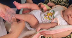 Bàn chân khoèo ở trẻ: Những điều cần biết