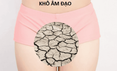Khô âm đạo có nguy hiểm không?