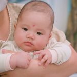 Xử lý dính thắng lưỡi nhanh gọn – Không cần nằm viện