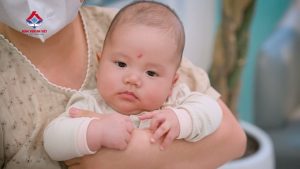 Xử lý dính thắng lưỡi nhanh gọn – Không cần nằm viện