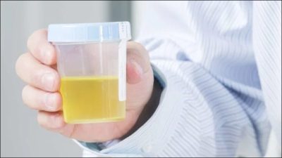 Nhiễm khuẩn đường tiểu: Nguyên nhân, dấu hiệu nhận biết