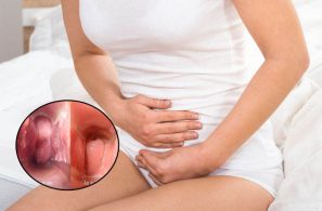 Những dấu hiệu cảnh báo viêm âm đạo