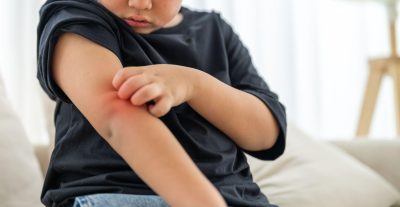 Cẩn trọng viêm não Nhật Bản ở trẻ vào mùa hè