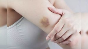 Những dấu hiệu bất thường cảnh báo gan đang có vấn đề