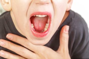 Viêm VA ở trẻ nhỏ: Không thể chủ quan trước biến chứng