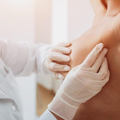 Áp xe vú: Những điều cần biết