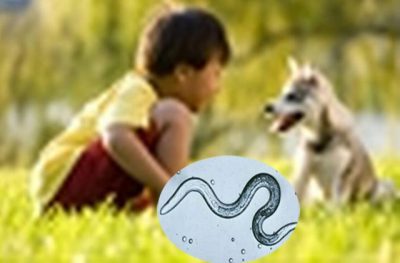 Nhiễm giun ở trẻ: Những điều cần biết