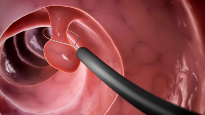 Polyp mũi khi nào cần phẫu thuật?
